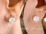 گوش‌های پیرم، راز سنم را فاش می‌کردند، اما حالا ۳۰ سال جوان‌تر به نظر می‌رسم!